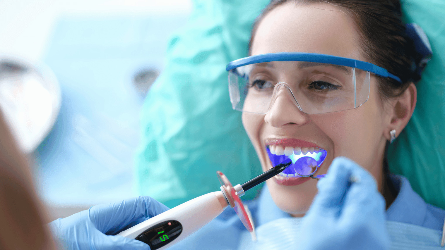 Dental bonding