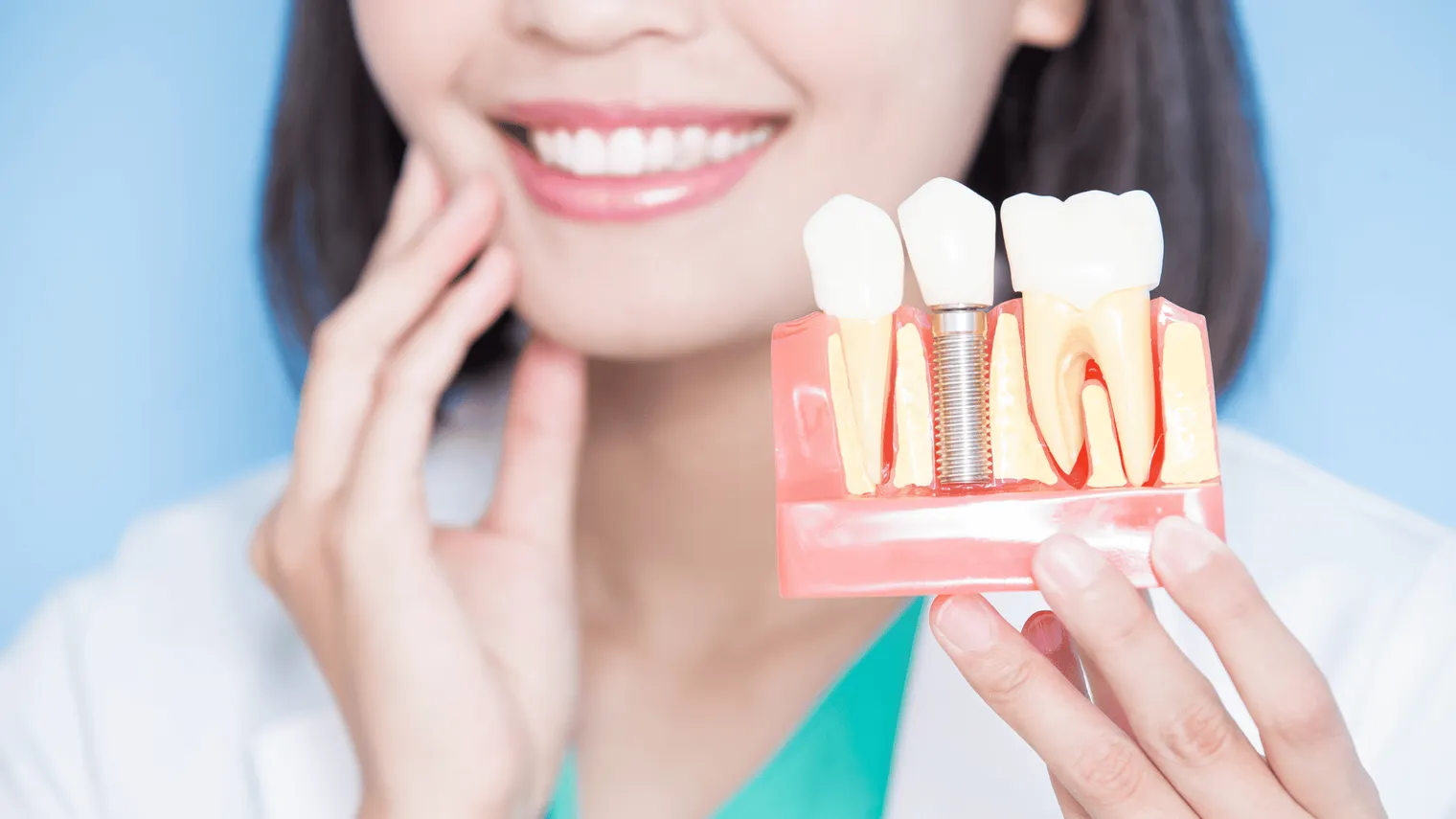Dental implants