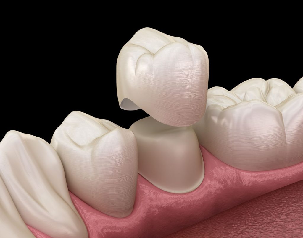 Restorative Dental Treatment