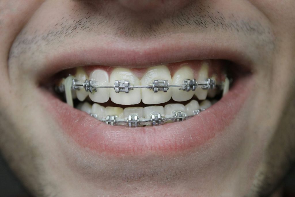 Cosmetic Dental Work New York NY