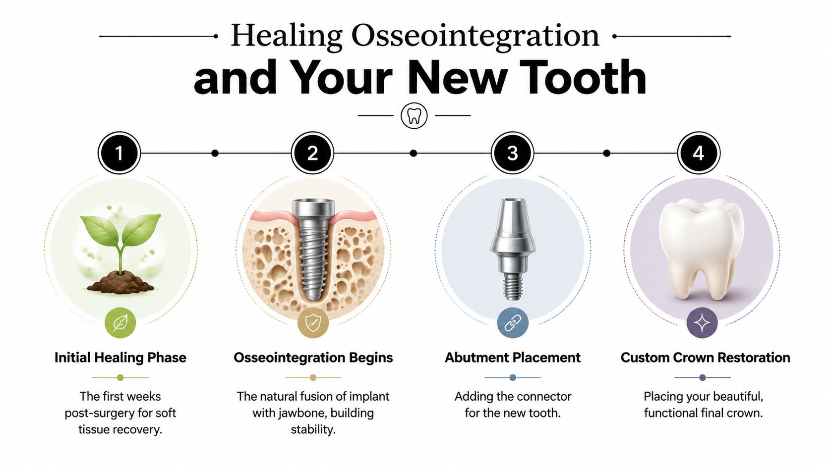 A four-step infographic illustrating the dental implant process from initial healing to the final crown restoration.