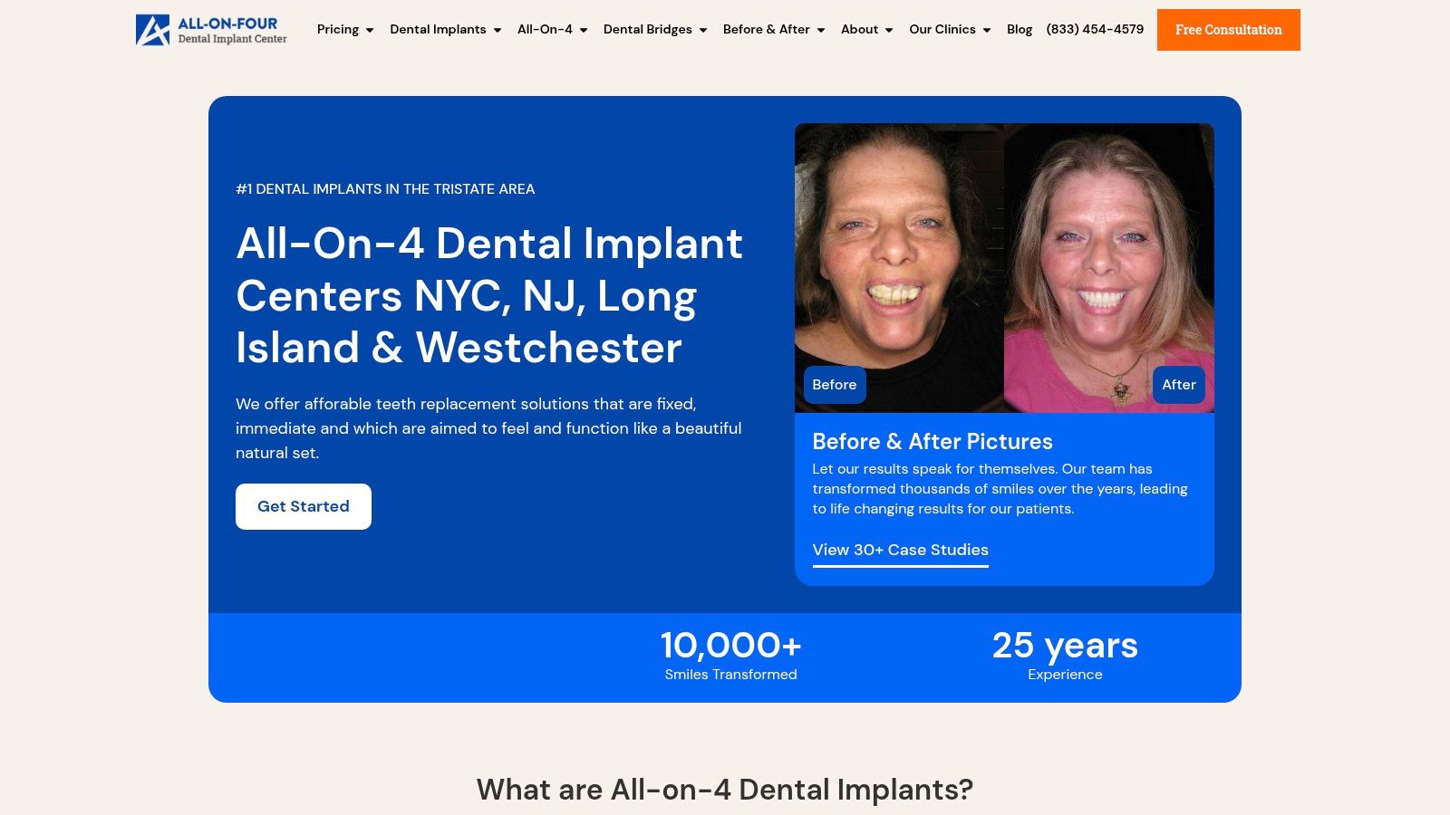 Nuvia Dental Implant Center (NuviaSmiles)