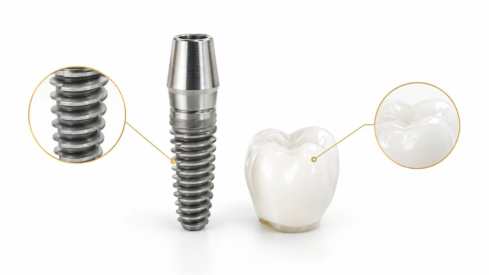 A close-up view of a dental implant screw alongside a ceramic dental crown on a white background.