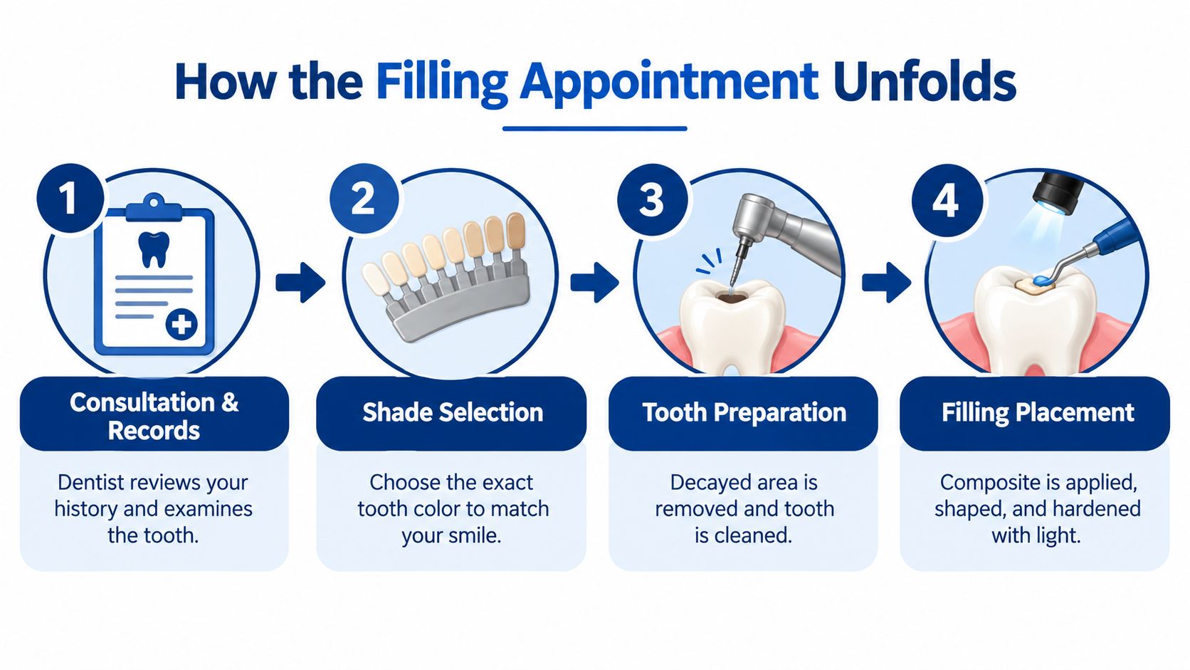 A four-step infographic illustrating the dental filling procedure from consultation to the final placement of the filling.