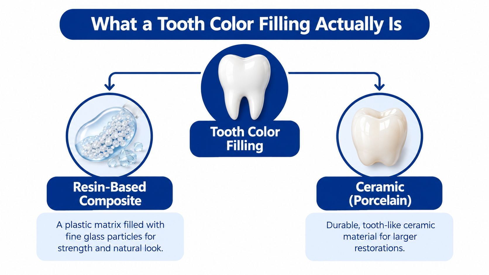 An infographic explaining tooth color fillings, comparing resin-based composite materials to ceramic porcelain restorations for dental care.